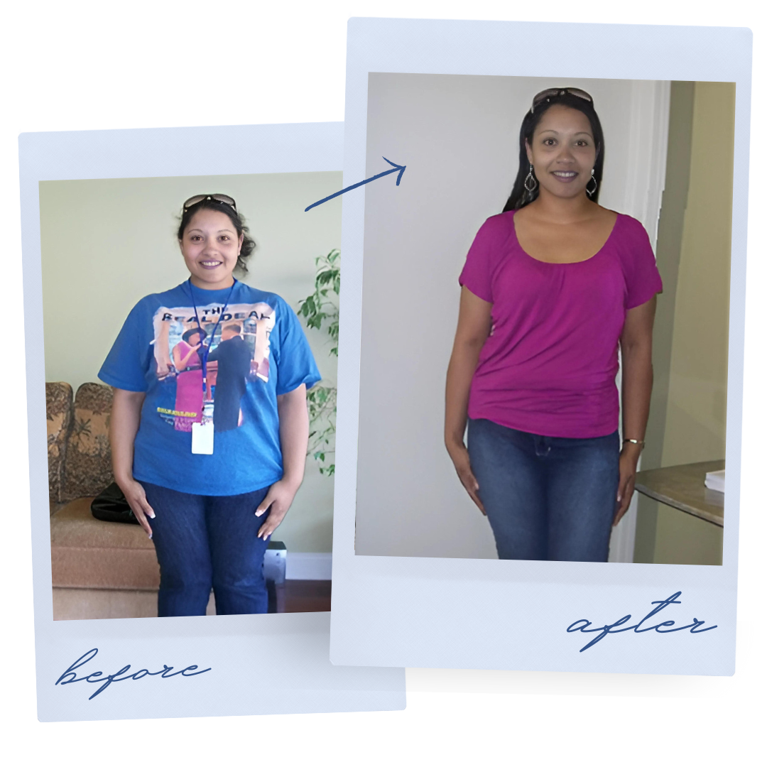 Historical patient-submitted before-and-after photographs, collection 1