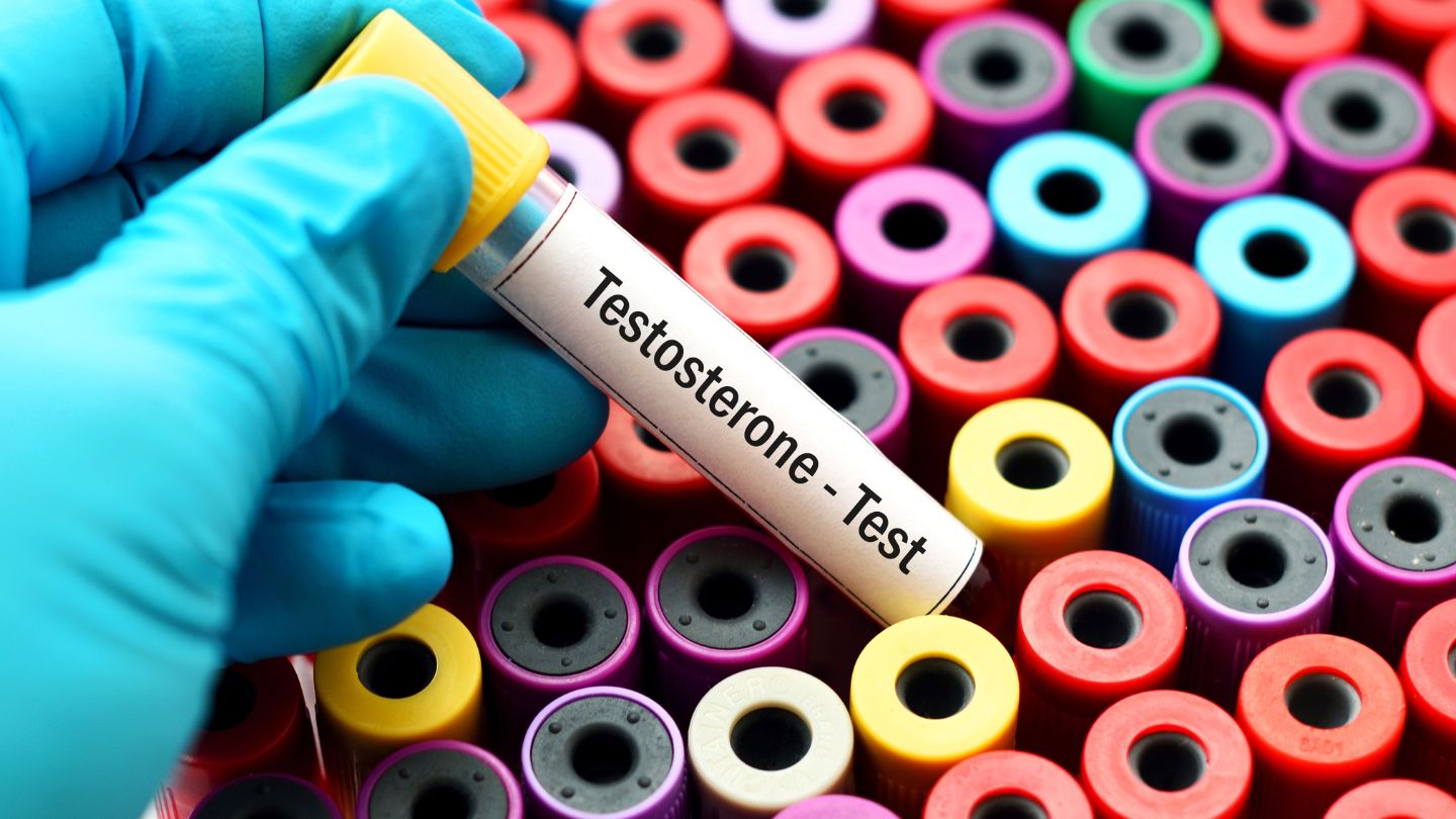 Exploring Testosterone Replacement Therapy (TRT)